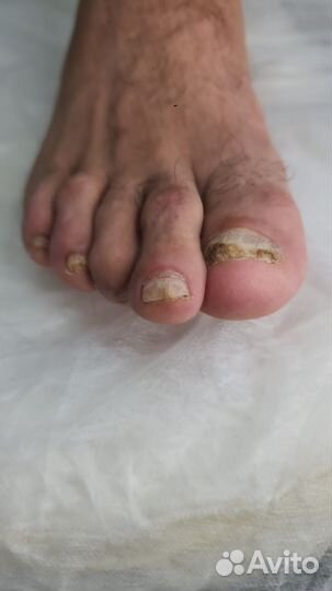 Подология. Маникюр. Педикюр