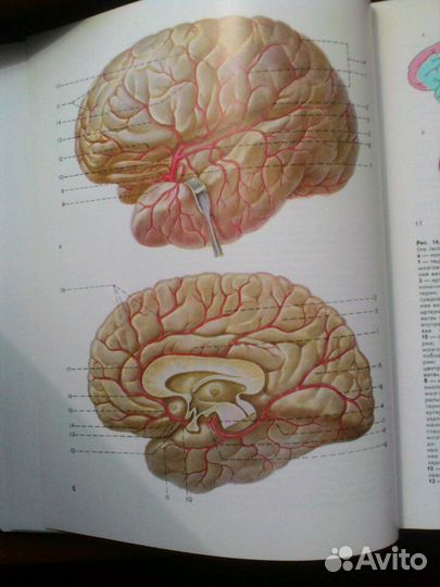 Сосудистые заболевания нервной системы Шмидт
