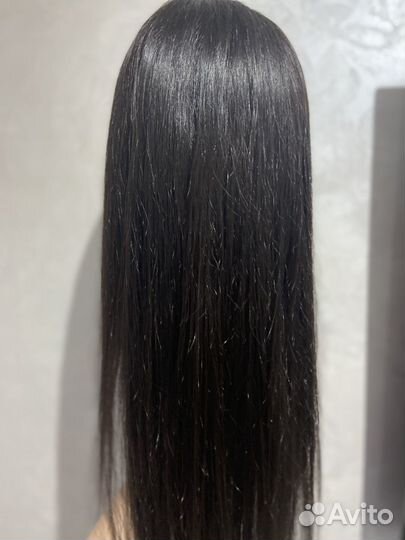 Система замещения волос