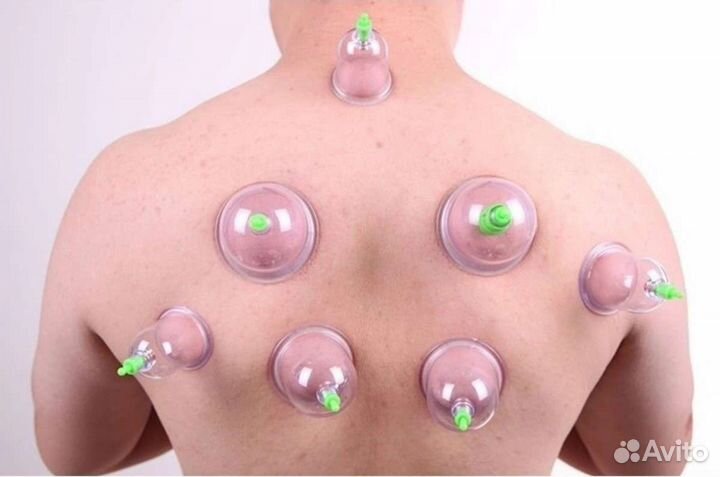 Вакуумные банки с насосом массажные банки