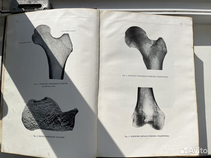 Анатомический атлас человеческого тела Будапешт
