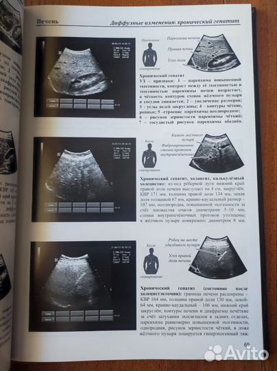 Атлас Аллахвердов узи ультразвуковой диагностики