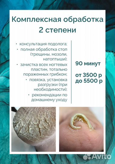 Педикюр подолог Омск Амур