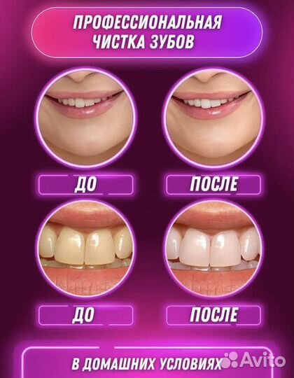 Электрическая зубная щетка ирригатор для зубов