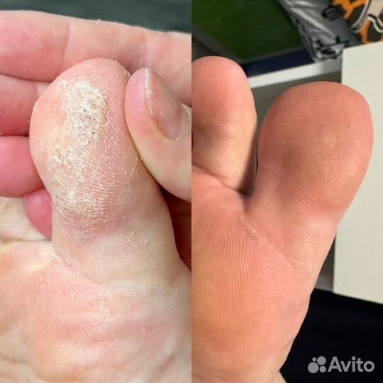 Подолог/Педикюр/Маникюр