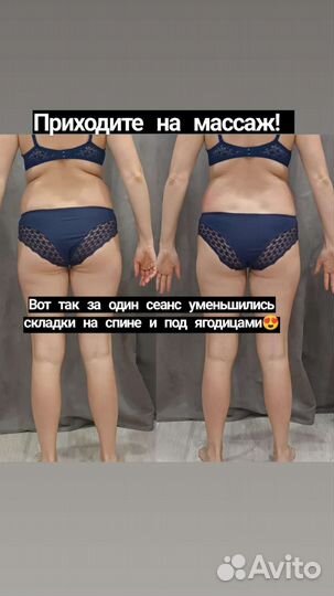 Антицеллюлитный массаж ручной