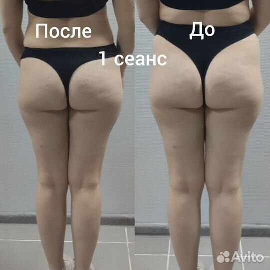 Модель на массаж