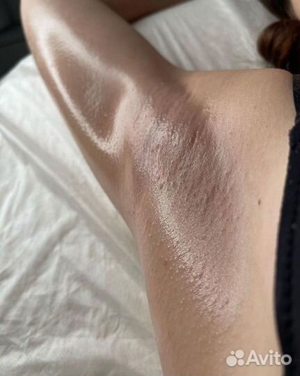 Шугаринг/лазерная эпиляция