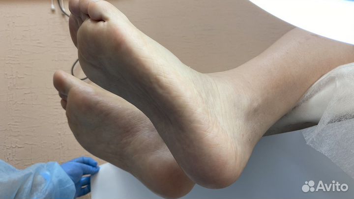 Педикюр, педикюр с покрытием гель-лак, дисковой