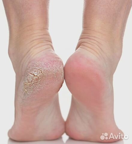 Маникюр, педикюр, наращивание ногтей