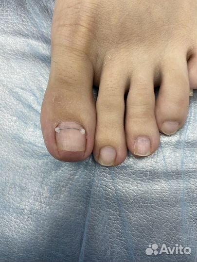 Услуги подолога