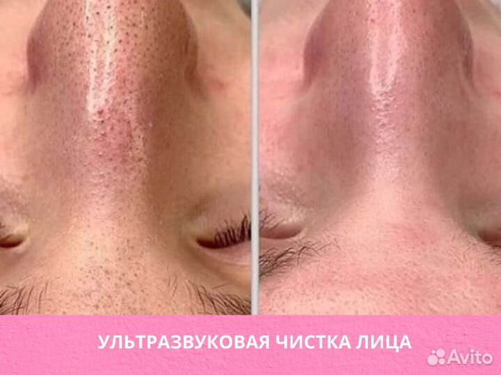 Обучение аппаратной косметологии с нуля