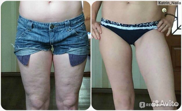 Массажи лечебный, антицеллюлитный спортивный