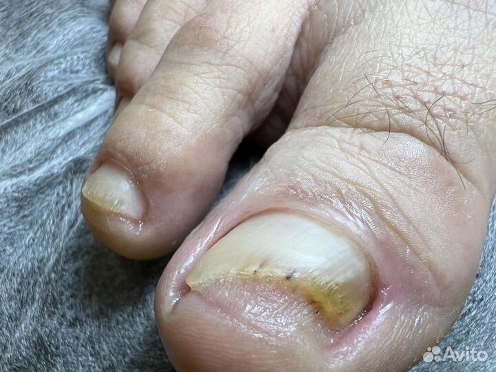 Услуги подолога,маникюр,педикюр