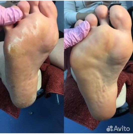 Услуги подолога