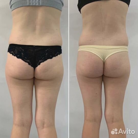 Коррекция фигуры. Изоджей. Гимнастика для ленивых