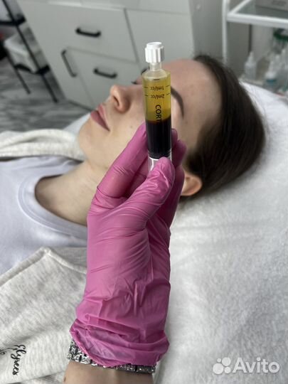 PRP терапия. Плазмолифтинг