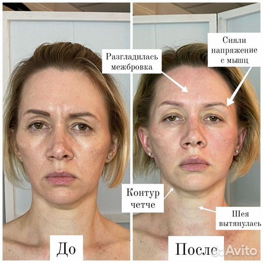 Массаж лица