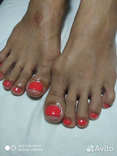 Аппаратный педикюр