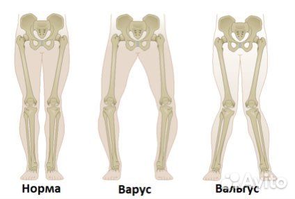 Детский массаж