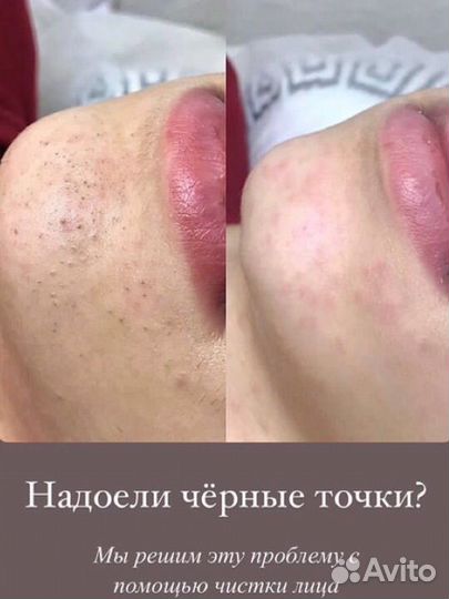 Услуги косметолога