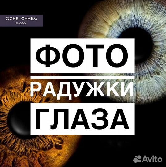 Фото радужки глаза Краснодар