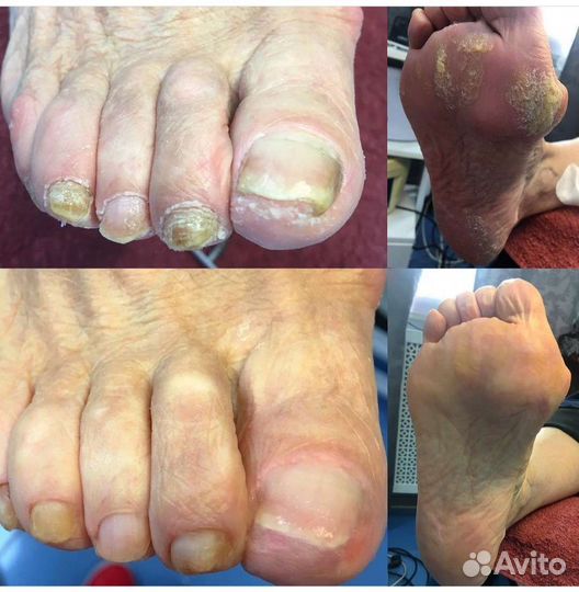 Услуги подолога