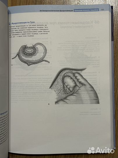 Атлас общей хирургии Шумпелик