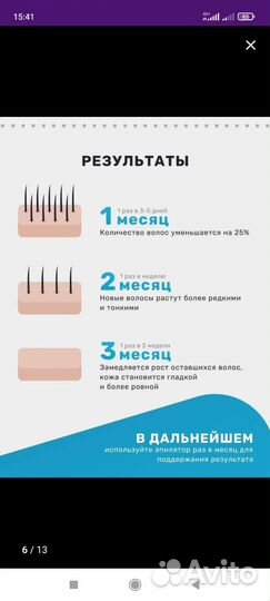 Эпилятор лазерный