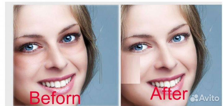 Аппарат для глаз. Массажёр для глаз