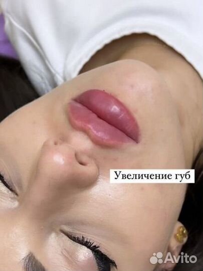 Врач косметолог