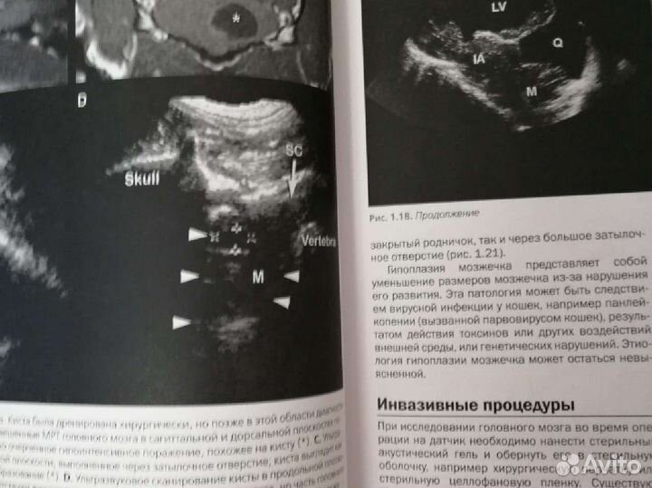 Атлас по ультразвуковой диагностике исследования