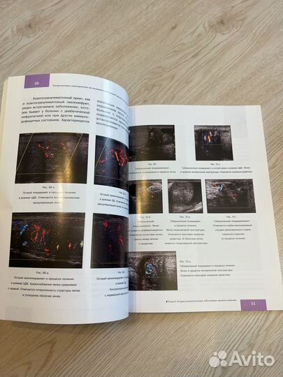 Атлас ультразвуковой диагностики органов мошонки