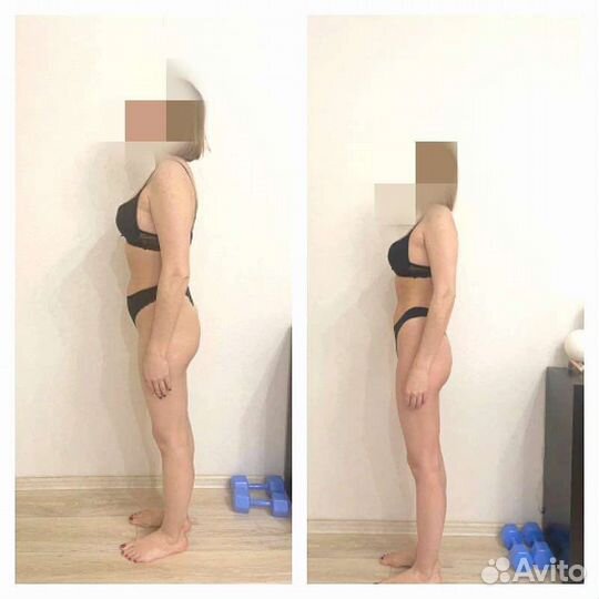 Антицеллюлитный массаж ручной