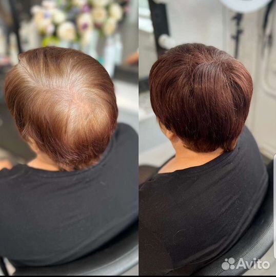 Накладка из термоволокна