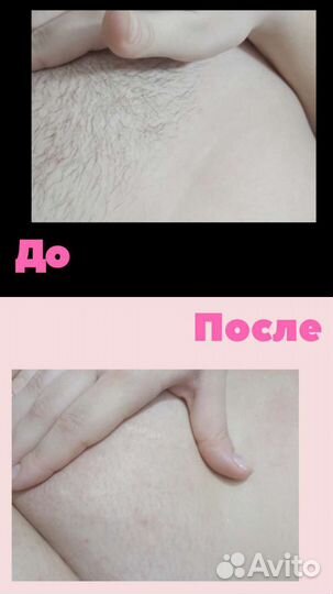 Мастер депиляции Reference France & Skin's