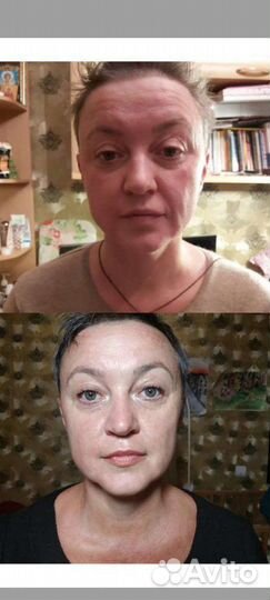 Массаж на выезд, Симферополь