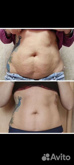 Миостимулятор для мышц