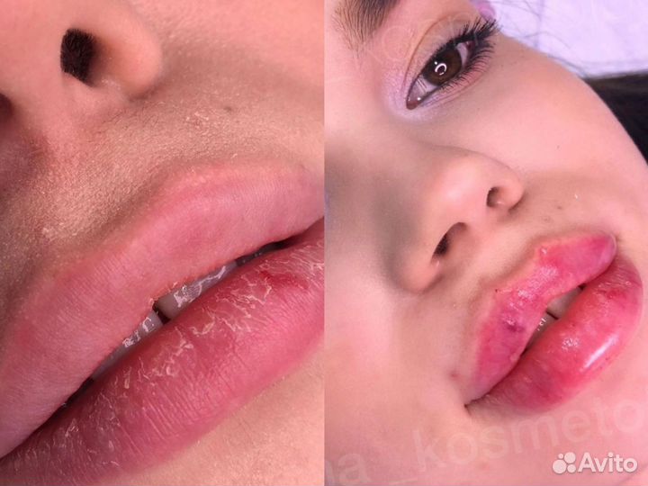 Услуги косметолога