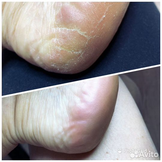 Педикюр,шугаринг