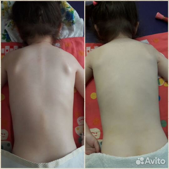 Детский массажист