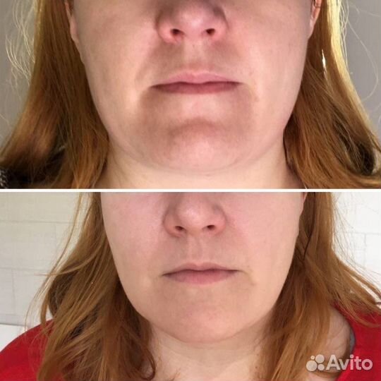 Скульптурный массаж лица для женщин