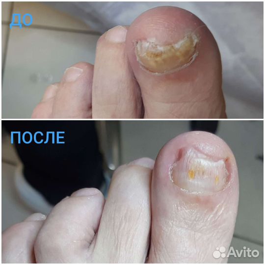 Услуги подолога