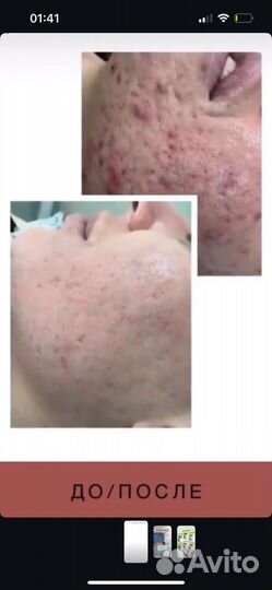 Холодная плазма