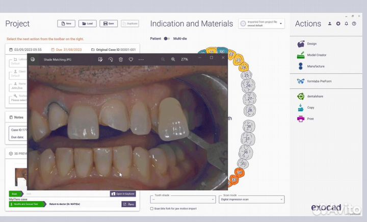 Exocad Elefsina 3.2 v8820 Все модули + Обучение