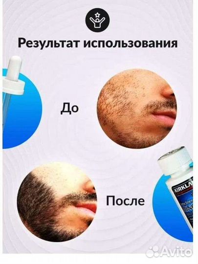 Миноксидил 5 оригинал для роста волос и бороды