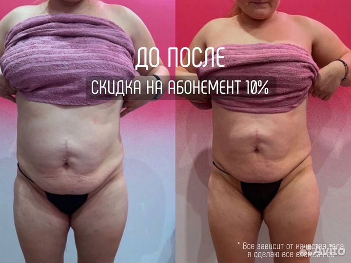 Антицеллюлитный массаж / Классический массаж