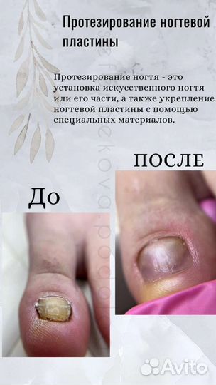 Подолог на выезд