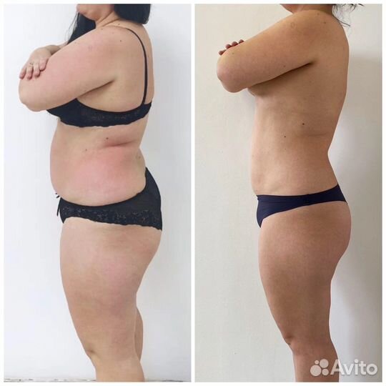 LPG вортекс бифлекси