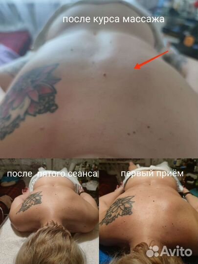 Авторский ручной массаж